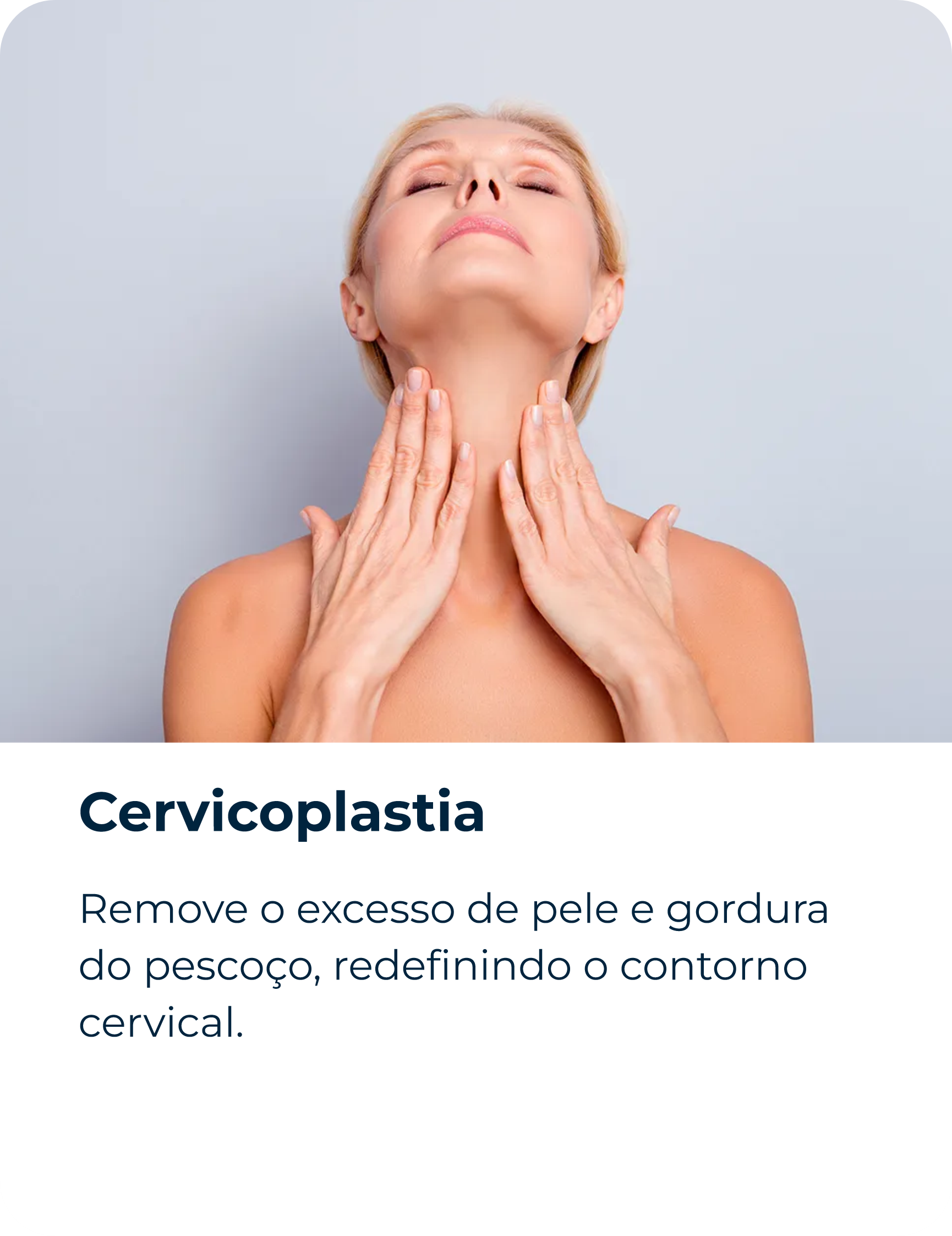 Cervicoplastia