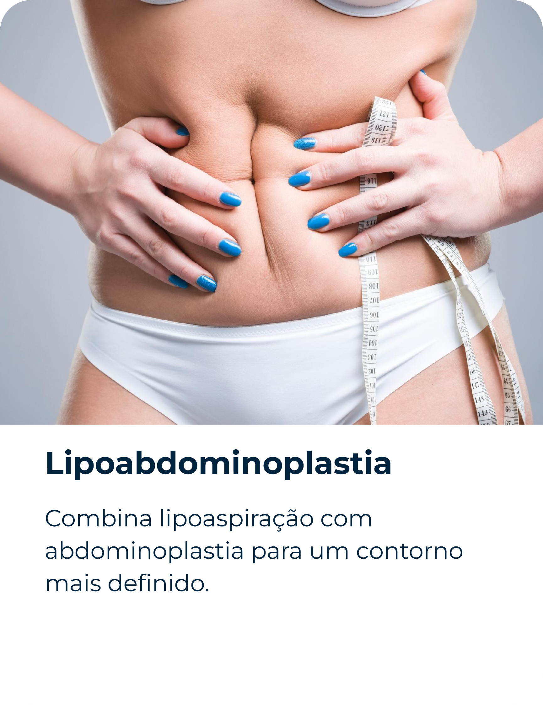Lipoabdominoplastia