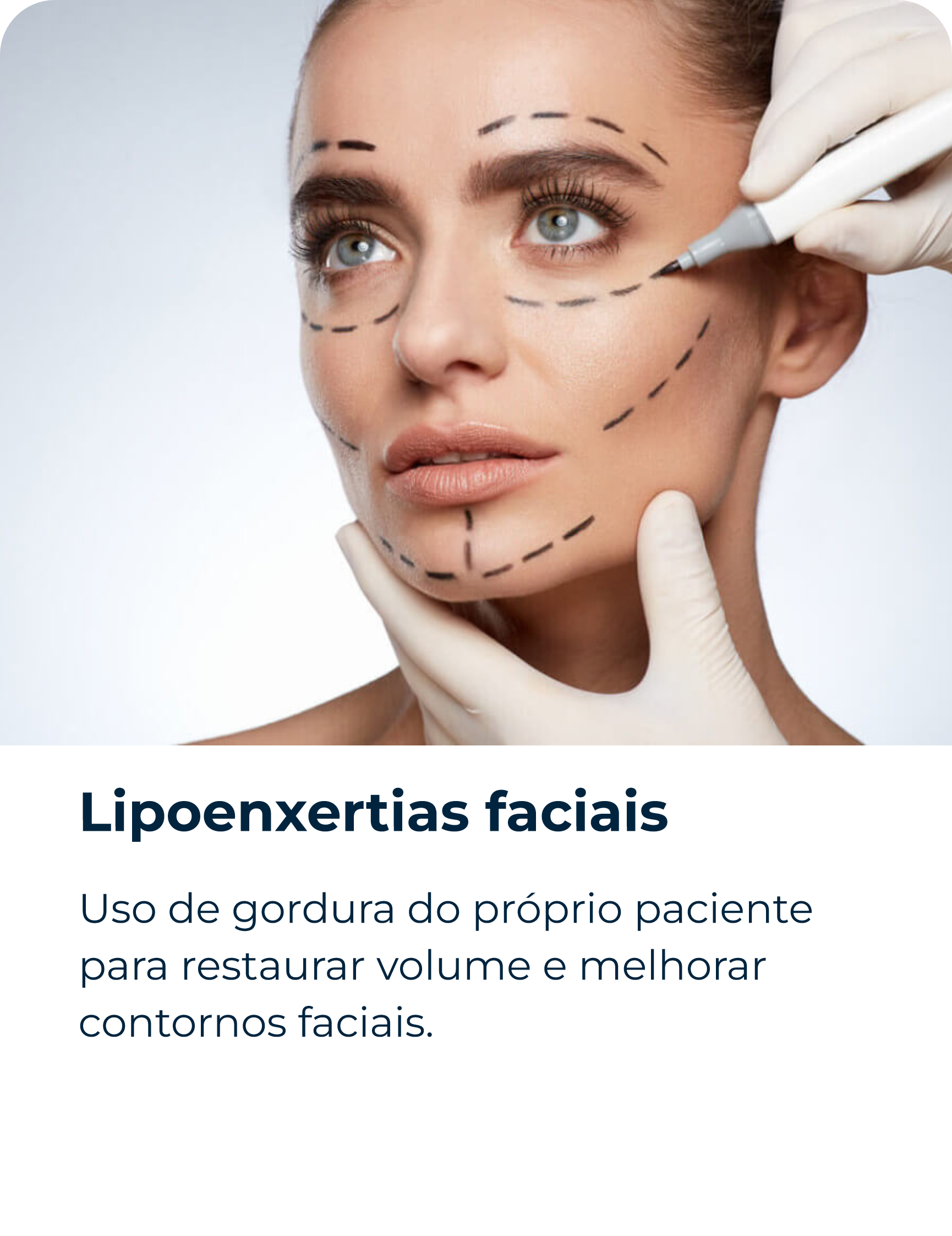 Lipoenxertias faciais