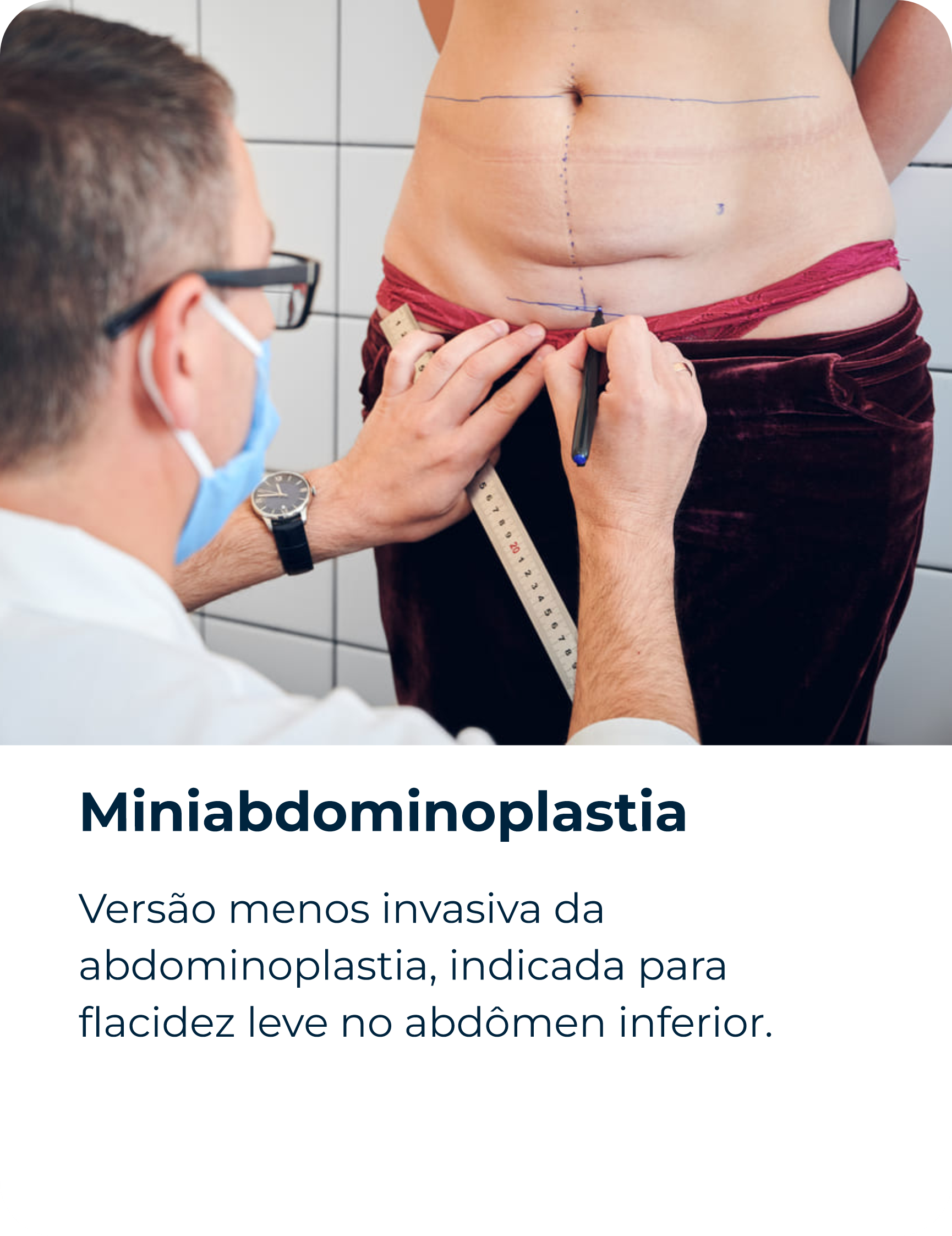 Miniabdominoplastia