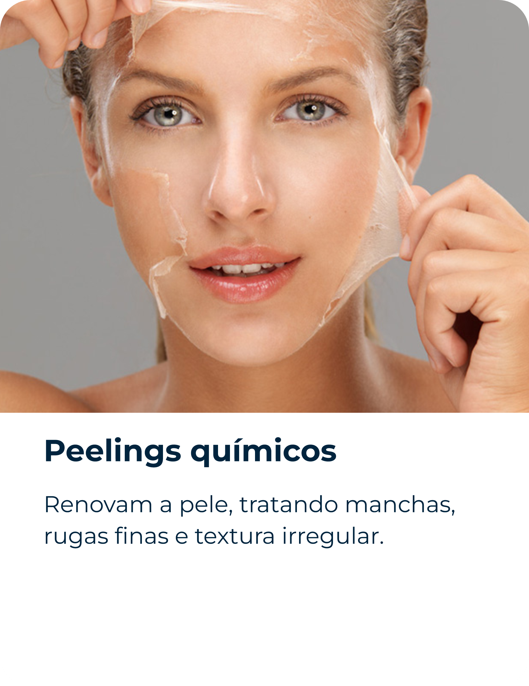 Peelings químicos